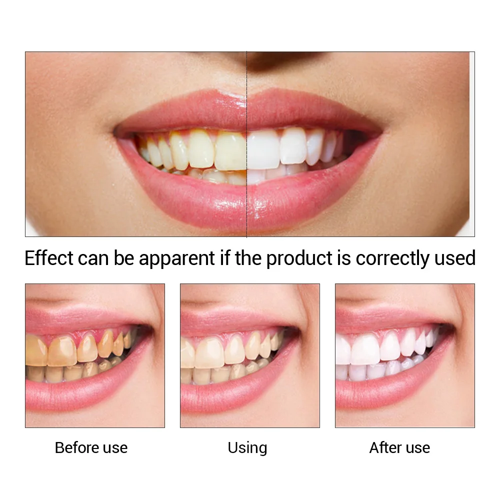FTEENPLY Bubuk Esensi Pemutih  - Teeth Whitening Near Me ulasan dan harga