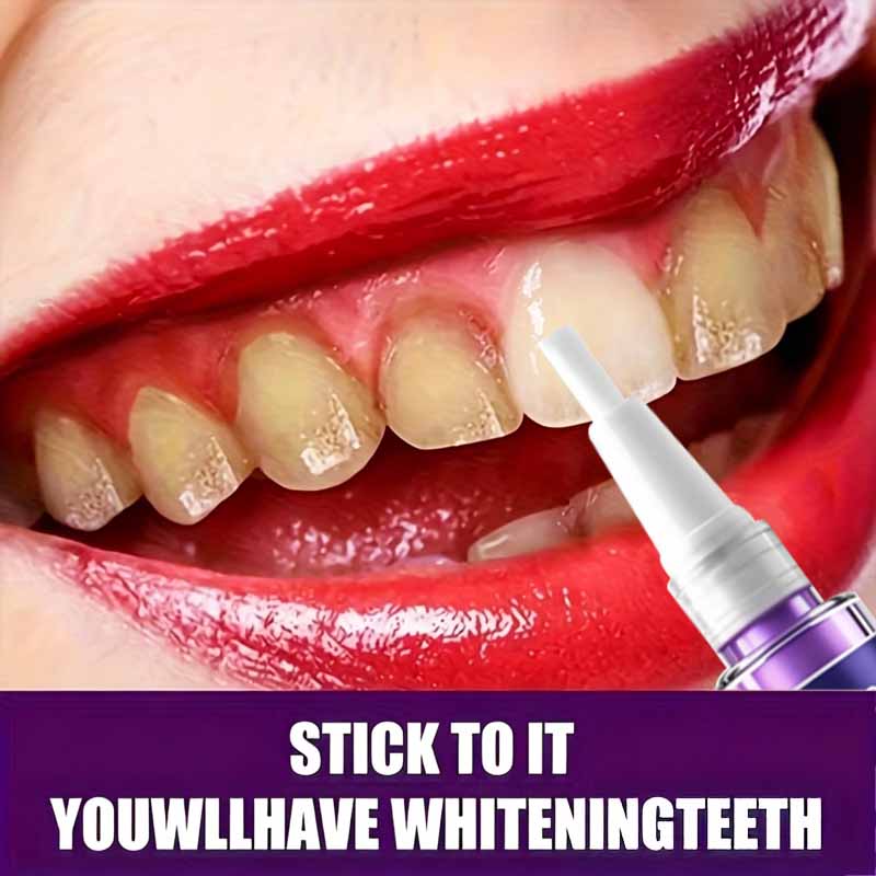 ROZINO 9D Pena Pemutih Gigi Ni - Teeth Whitening Pens ulasan dan harga