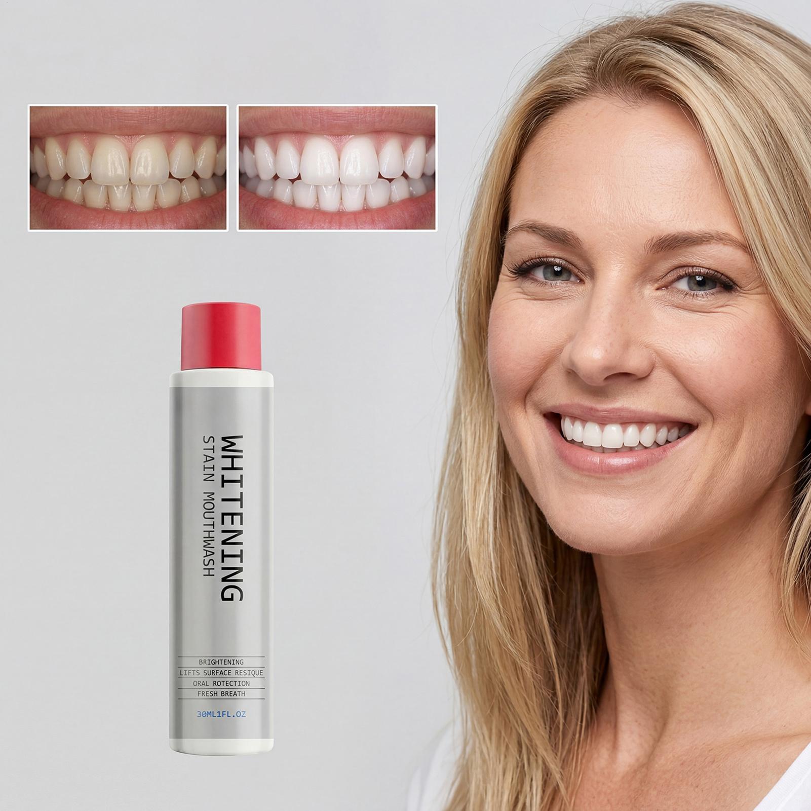 Obat Kumur Pemutih Noda 30ml M - Teeth Whitening Mouthwash ulasan dan harga