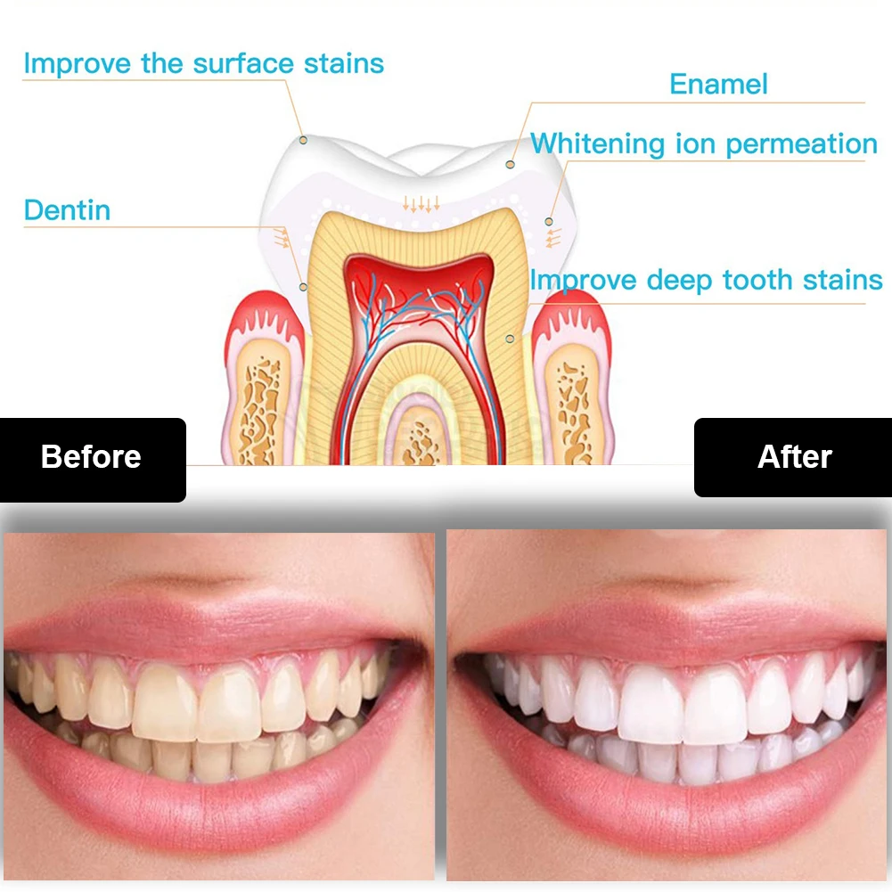 Kit pemutih gigi Mini 16 LED c - Teeth Whitening Near Me ulasan dan harga