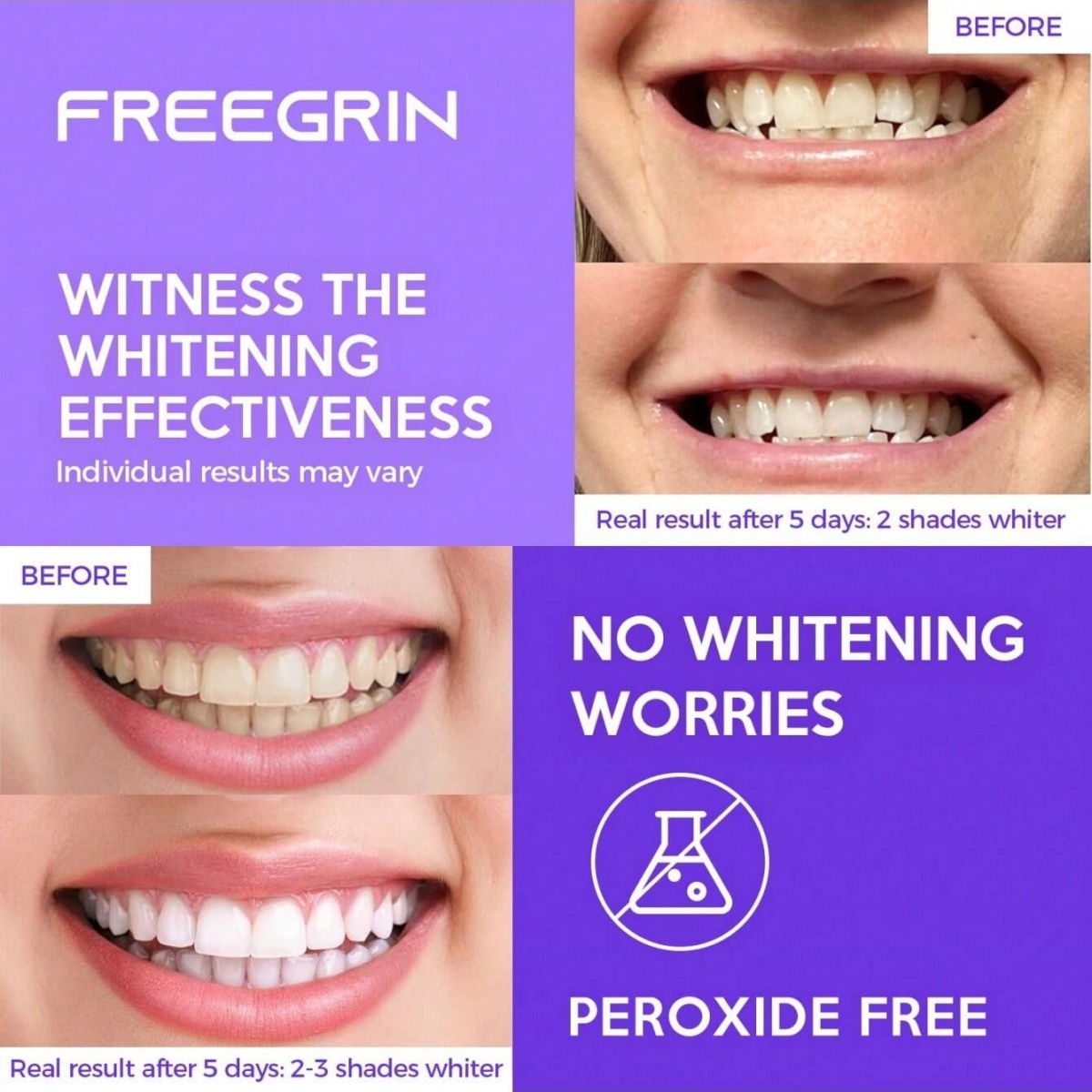 Stiker Gigi Pemutih Mewah 7/14 - Teeth Whitening Near Me ulasan dan harga