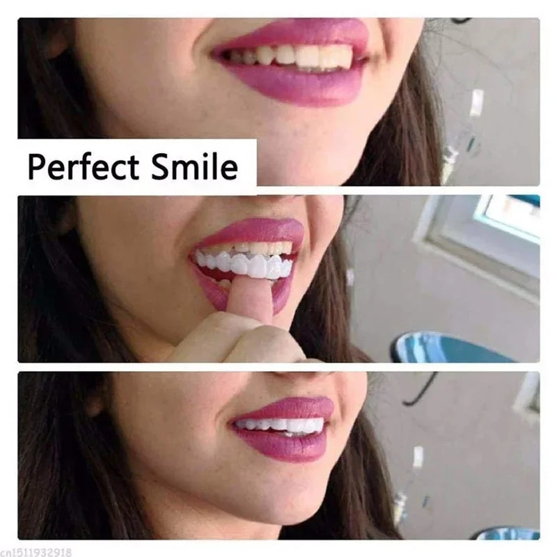 Set Veneer Gigi yang Dapat Dip - Teeth Whitening Kit ulasan dan harga