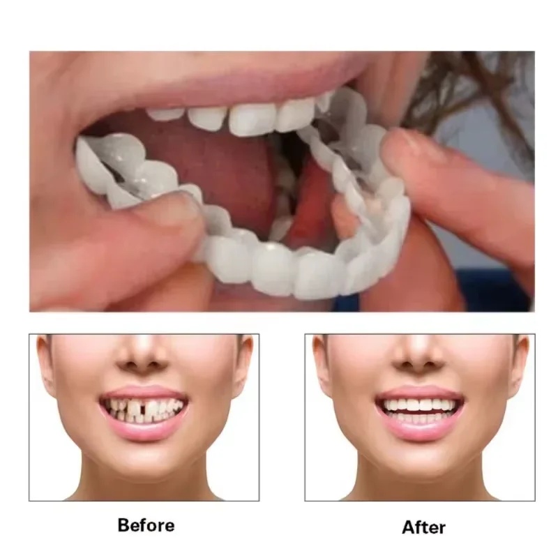 Set Veneer Gigi yang Dapat Dip - Teeth Whitening Kit ulasan dan harga